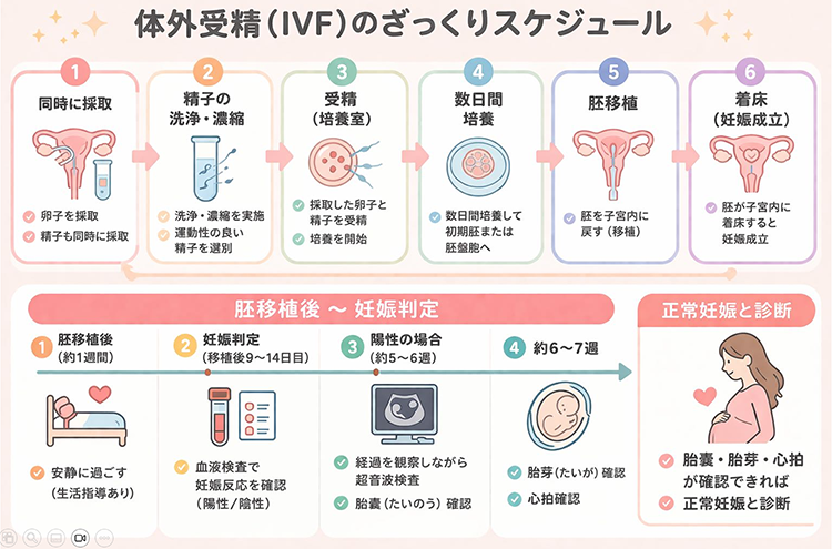 体外受精